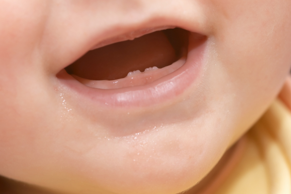 赤ちゃんの乳歯